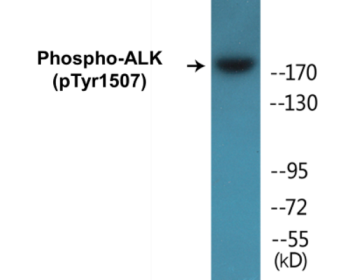 Phospho-ALK (Tyr1507) Colorimetric Cell-Based ELISA Kit