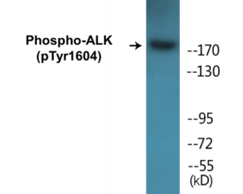 Phospho-ALK (Tyr1604) Colorimetric Cell-Based ELISA Kit