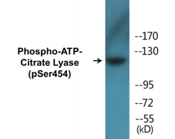 Phospho-ATP-Citrate Lyase (Ser454) Colorimetric Cell-Based ELISA Kit