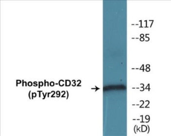 Phospho-CD32 (Tyr292) Colorimetric Cell-Based ELISA Kit