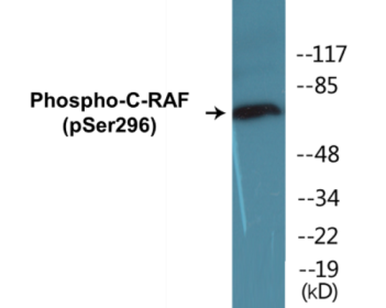 Phospho-C-RAF (Ser296) Colorimetric Cell-Based ELISA Kit