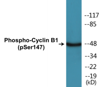 Phospho-Cyclin B1 (Ser147) Colorimetric Cell-Based ELISA Kit