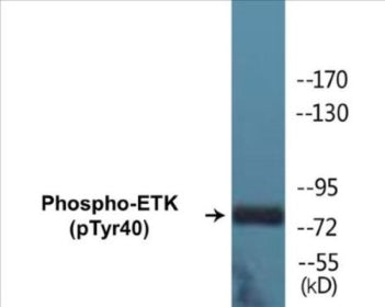 Phospho-ETK (Tyr40) Colorimetric Cell-Based ELISA Kit