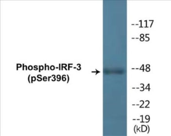 Phospho-IRF-3 (Ser396) Colorimetric Cell-Based ELISA Kit