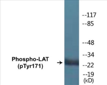 Phospho-LAT (Tyr171) Colorimetric Cell-Based ELISA Kit