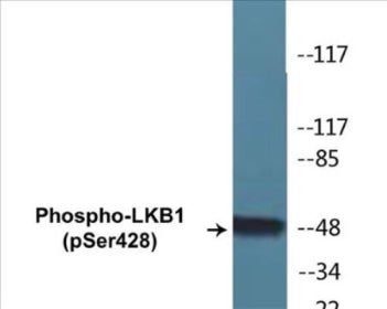 Phospho-LKB1 (Ser428) Colorimetric Cell-Based ELISA Kit