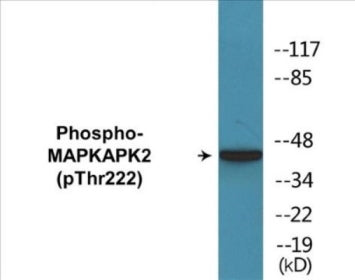 Phospho-MAPKAPK2 (Thr222) Colorimetric Cell-Based ELISA Kit