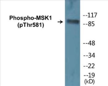 Phospho-MSK1 (Thr581) Colorimetric Cell-Based ELISA Kit