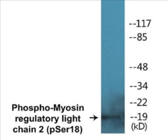 Phospho-MYL9 (Ser18) Colorimetric Cell-Based ELISA Kit