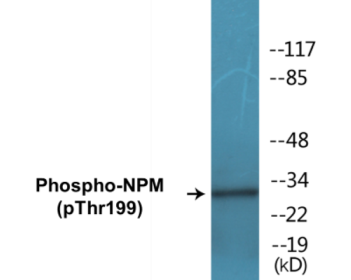 Phospho-NPM (Thr199) Colorimetric Cell-Based ELISA Kit