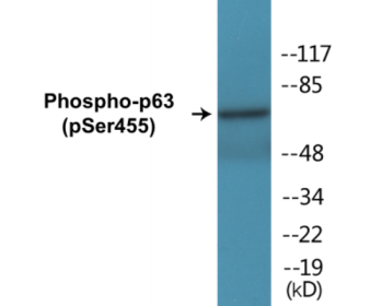 Phospho-p63 (Ser455) Colorimetric Cell-Based ELISA Kit