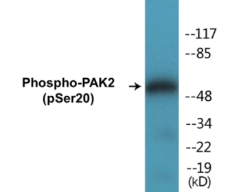 Phospho-PAK2 (Ser20) Colorimetric Cell-Based ELISA Kit