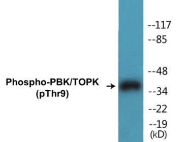 Phospho-PBK/TOPK (Thr9) Colorimetric Cell-Based ELISA Kit