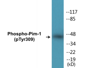 Phospho-Pim-1 (Tyr309) Colorimetric Cell-Based ELISA Kit