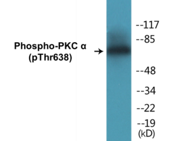 Phospho-PKC alpha (Thr638) Colorimetric Cell-Based ELISA Kit