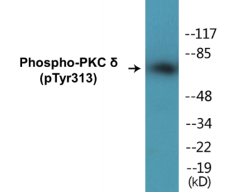 Phospho-PKC delta (Tyr313) Colorimetric Cell-Based ELISA Kit