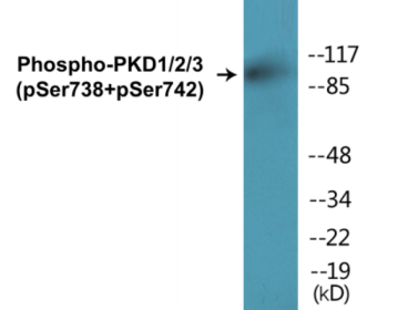 Phospho-PKD1/2/3 (Ser738+Ser742) Colorimetric Cell-Based ELISA Kit