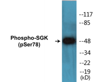 Phospho-SGK (Ser78) Colorimetric Cell-Based ELISA Kit
