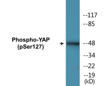 Phospho-YAP (Ser127) Colorimetric Cell-Based ELISA Kit