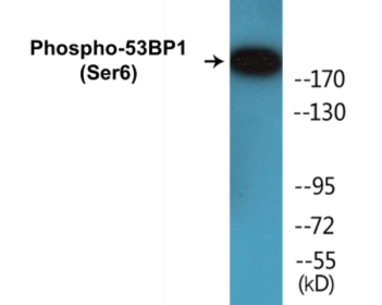 Phospho-53BP1 (Ser6) Colorimetric Cell-Based ELISA Kit