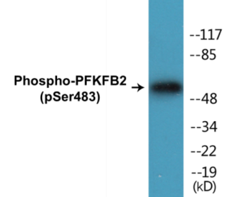 Phospho-PFKFB2 (Ser483) Colorimetric Cell-Based ELISA Kit