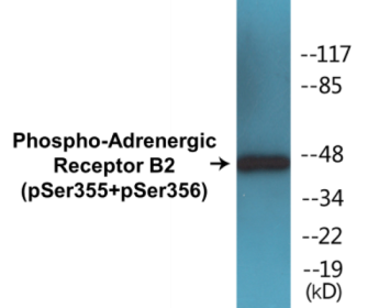Phospho-ADRB2 (Ser355+Ser356) Colorimetric Cell-Based ELISA Kit