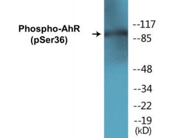 Phospho-AhR (Ser36) Colorimetric Cell-Based ELISA Kit