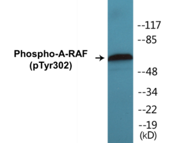 Phospho-A-RAF (Tyr302) Colorimetric Cell-Based ELISA Kit