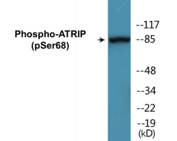 Phospho-ATRIP (Ser68) Colorimetric Cell-Based ELISA Kit