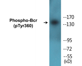 Phospho-Bcr (Tyr360) Colorimetric Cell-Based ELISA Kit