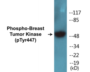 Phospho-Breast Tumor Kinase (Tyr447) Colorimetric Cell-Based ELISA Kit