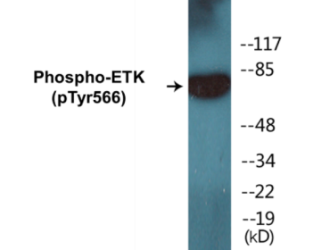 Phospho-ETK (Tyr566) Colorimetric Cell-Based ELISA Kit
