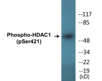 Phospho-HDAC1 (Ser421) Colorimetric Cell-Based ELISA Kit