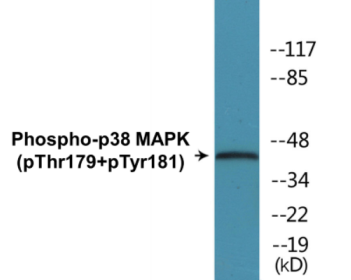 Phospho-p38 MAPK (Thr179+Tyr181) Colorimetric Cell-Based ELISA Kit