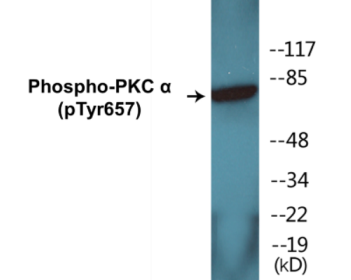 Phospho-PKC alpha (Tyr657) Colorimetric Cell-Based ELISA Kit