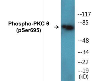 Phospho-PKC theta (Ser695) Colorimetric Cell-Based ELISA Kit