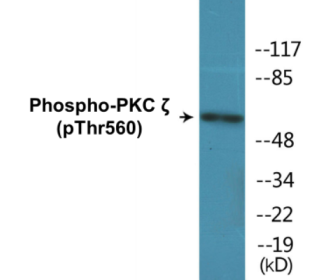 Phospho-PKC zeta (Thr560) Colorimetric Cell-Based ELISA Kit