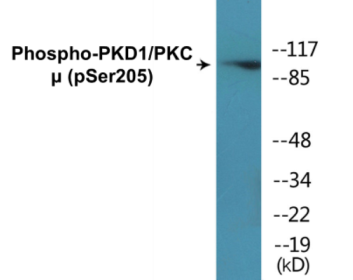 Phospho-PKD1/PKC mu (Ser205) Colorimetric Cell-Based ELISA Kit
