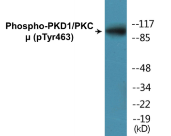 Phospho-PKD1/PKC mu (Tyr463) Colorimetric Cell-Based ELISA Kit