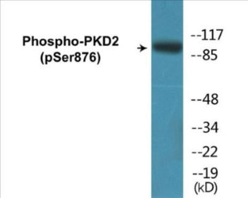 Phospho-PKD2 (Ser876) Colorimetric Cell-Based ELISA Kit