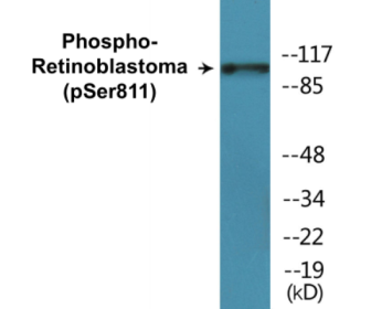 Phospho-Retinoblastoma (Ser811) Colorimetric Cell-Based ELISA Kit