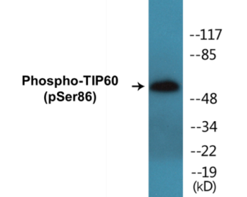 Phospho-TIP60 (Ser86) Colorimetric Cell-Based ELISA Kit