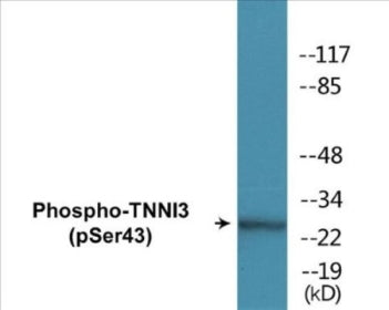 Phospho-TNNI3 (Ser43) Colorimetric Cell-Based ELISA Kit