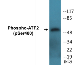 Phospho-ATF2 (Ser480) Colorimetric Cell-Based ELISA Kit