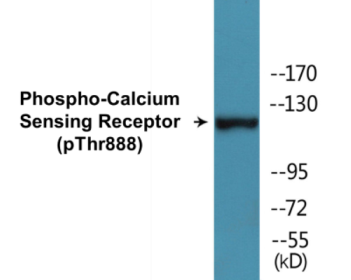 Phospho-Calcium Sensing Receptor (Thr888) Colorimetric Cell-Based ELISA Kit