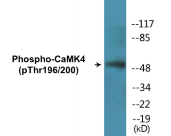 Phospho-CaMK4 (Thr196/200) Colorimetric Cell-Based ELISA Kit