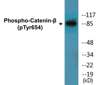 Phospho-Catenin-beta (Tyr654) Colorimetric Cell-Based ELISA Kit