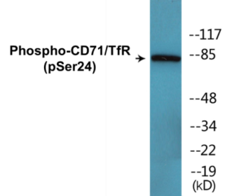 Phospho-CD71/TfR (Ser24) Colorimetric Cell-Based ELISA Kit
