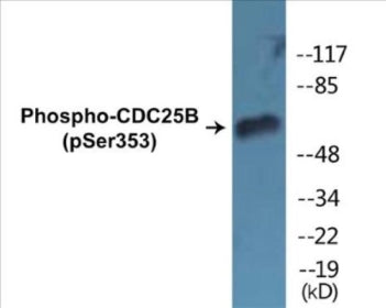 Phospho-CDC25B (Ser353) Colorimetric Cell-Based ELISA Kit