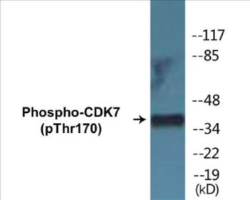 Phospho-CDK7 (Thr170) Colorimetric Cell-Based ELISA Kit